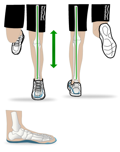 インソールによる足圧分散の比較イメージ